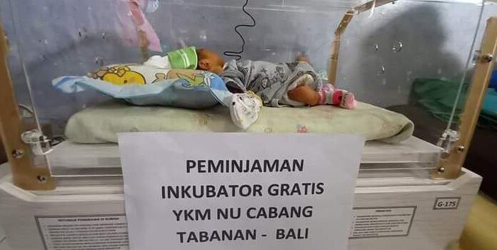 Inkubator Gratis, Kisah YKMNU Bali Bantu Bayi Lahir Prematur